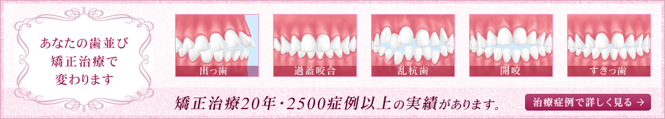 あなたの歯並び矯正治療で変わります矯正治療20年・2500症例以上の実績があります。